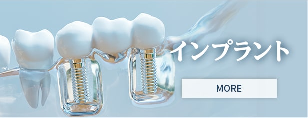 インプラント