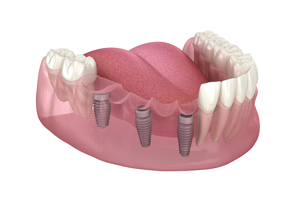 新宿駅新南口・代々木駅・新宿駅南口歯科三島